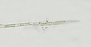 Illustration for article titled A Warm Ocean "Blob" In the Pacific Is Feeding a Toxic Algae BloomÂ